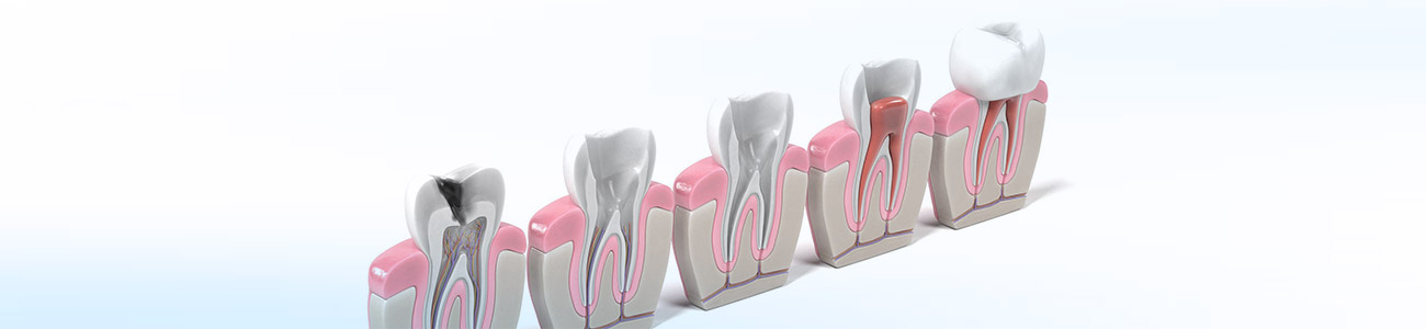Endodonti