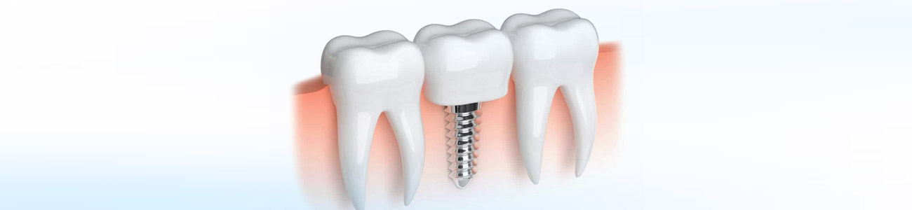 Periodontoloji